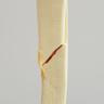 Knee with Bicondylar and Oblique Fractures of the Tibia, Full Length