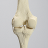 Knee Replacement with Tibia and Femur for #1301-169 and 1301-169-1