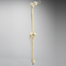Knee Replacement with Tibia and Fibula