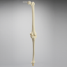 Knee Replacement for Hip Assembly #1301-160