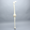 Knee Replacement for Hip Assembly #1301-161