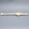 Knee with Plateau Fracture