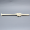 Knee with Plateau Fracture