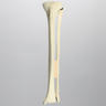 Tibia and Fibula with Fibular Rotation