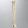 Tibia and Fibula with Fibular Rotation