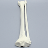 Tibia and Fibula, Right, Large