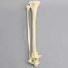 Tibia and Fibula with Pilon and Fractures