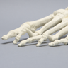 Foot and Ankle with Hammertoes, Bunions, and Heel Spur