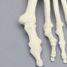 Foot and Ankle with Hammertoes, Bunions, and Heel Spur