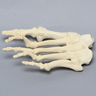 Forefoot with Hammertoes, Bunions, Exostosis, and Canals