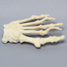 Forefoot with Hammertoes, Bunions, Exostosis, and Canals