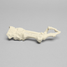 Metatarsals with Hammertoe and Bunion