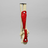 Ankle Joint with Ruptured Achilles