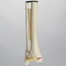 Ankle with Medial Malleolar and Oblique Fractures