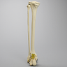 Foot and Ankle with Three-Part Calcaneal Fracture