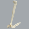 Foot and Ankle with Rocker-Foot Syndrome