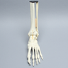 Foot and Ankle with Tibial Three-Part Pilon and Fibular Oblique Fractures