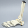 Foot and Ankle with Tibial Three-Part Pilon and Fibular Oblique Fractures
