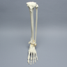 Foot and Ankle with Pilon Fracture