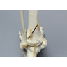 Foot and Ankle with Pilon Fracture