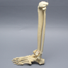 Foot and Ankle with Articulation and Tibial Pilon and Transverse Fibular Fractures