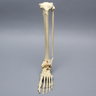 Foot and Ankle with Articulation and Tibial Pilon and Transverse Fibular Fractures