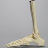 Foot and Ankle with Fractures and Articulation at IP Joint