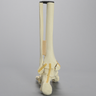 Foot and Ankle with Fractures and Articulation at IP Joint