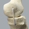 Full Leg with Three Stretch Cord Knee Ligaments