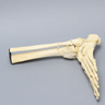 Foot and Ankle with Tibial Pilon and Fibular Oblique Fractures and Talar Rotation