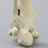 Foot and Ankle with Fusion, Abduction, and Equinus Deformities