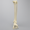 Foot and Ankle with Fusion, Abduction, and Equinus Deformities