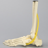 Foot and Ankle with Four-Part Calcaneal Fracture