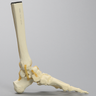 Foot and Ankle with Cavus Deformity