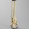 Foot and Ankle with Cavus Deformity