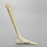Foot and Ankle with Multiple Deformities