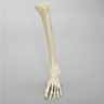 Foot and Ankle with Multiple Deformities