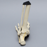 Foot and Ankle with Lisfranc Fracture