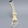 Foot and Ankle with Lisfranc Fracture