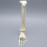 Foot and Ankle with Tibial Four-Part Pilon and Fibular Oblique Fractures