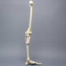 Full Leg with Femoral "Y" and Tibial Oblique Fractures