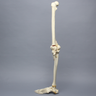 Full Leg with Femoral "Y" and Tibial Oblique Fractures