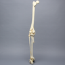 Full Leg with Femoral "Y" and Tibial Oblique Fractures