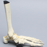Foot and Ankle with Wall and Neck Fractures of Calcaneus and Talus