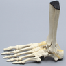 Foot and Ankle with Wall and Neck Fractures of Calcaneus and Talus
