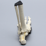 Foot and Ankle with Wall and Neck Fractures of Calcaneus and Talus