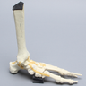 Foot and Ankle with Lisfranc and Cuboid Fractures