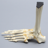 Foot and Ankle with Lisfranc and Cuboid Fractures