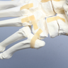 Foot and Ankle with Lisfranc and Cuboid Fractures