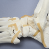 Foot and Ankle with Lisfranc and Cuboid Fractures